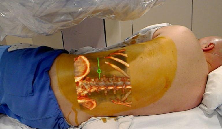 La réalité augmentée en chirurgie