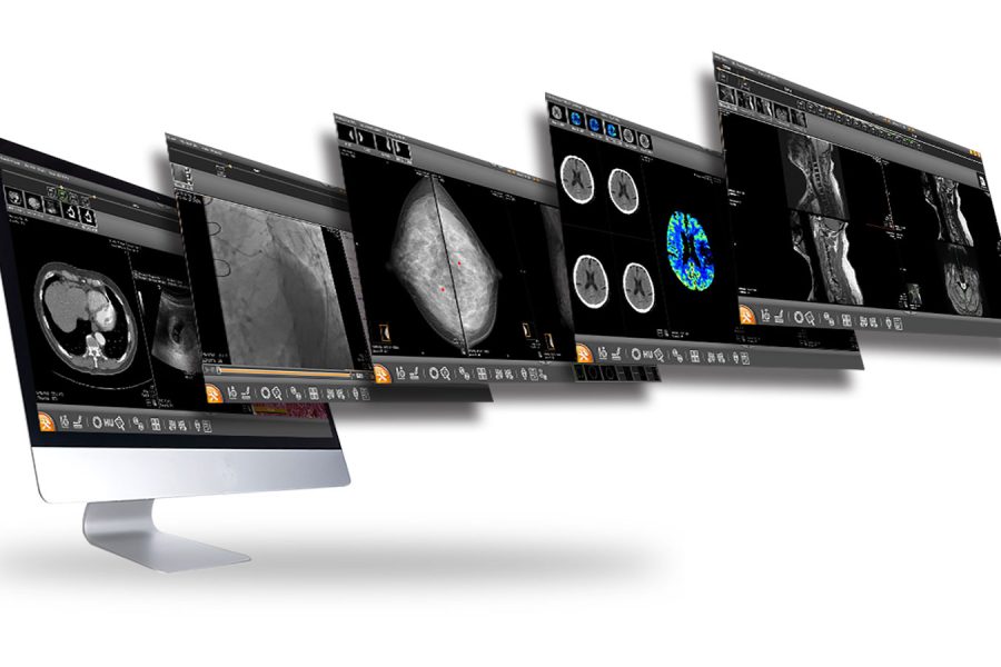 PACS médical : comment fonctionne ce système d’imagerie ?