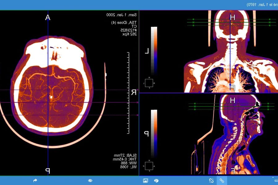 PACS MACS : que signifie ce terme en imagerie ?
