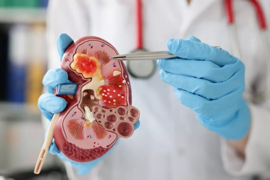 Collège néphrologie : cours, stages et outils pour se perfectionner