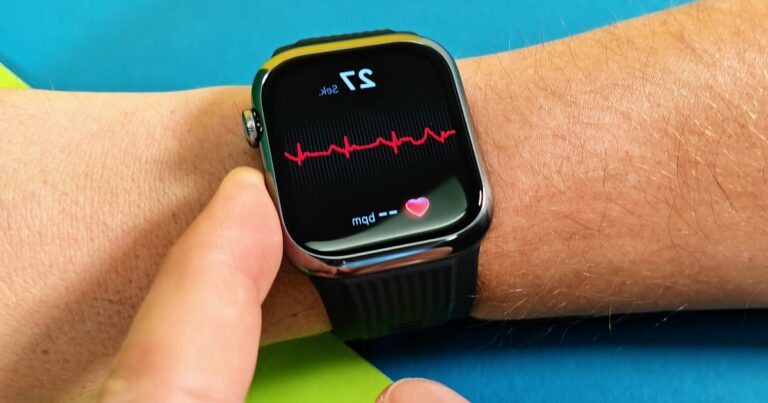 montre-ecg