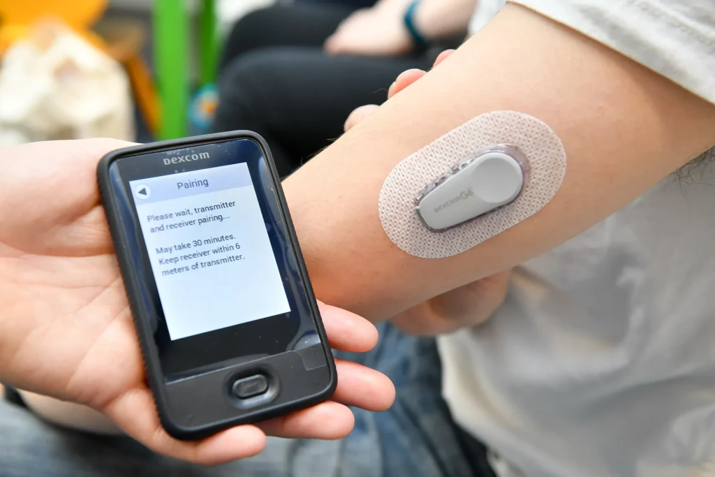 dexcom