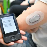 Dexcom : avantages concrets pour mieux gérer la glycémie au quotidien