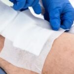 Échelle de Braden : évaluer efficacement le risque d’escarres