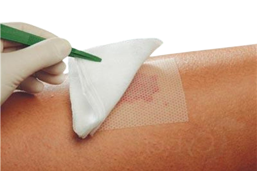 Pansement interface : à quoi sert-il et quand l’utiliser efficacement