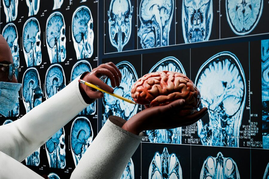 IRM cérébrale : déroulement et indications, comprendre vraiment cet examen