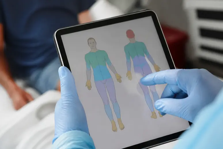 Application mobile pour estimer la surface brûlée, alternative à la règle des 9 de Wallace.